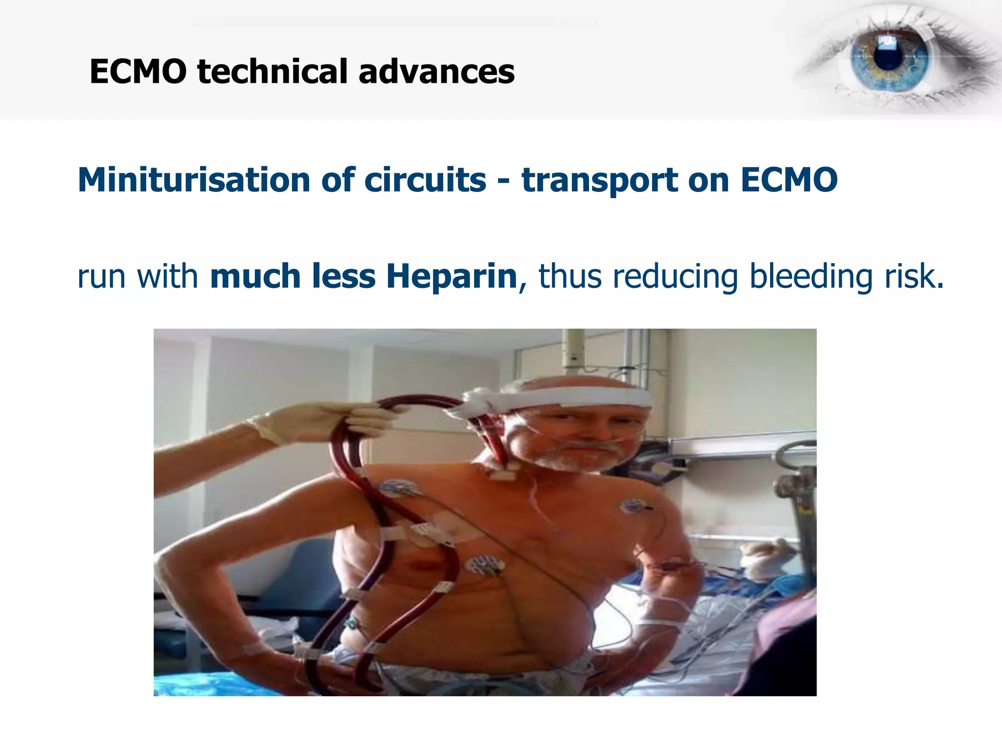 Uihc Emcmo Ecmo dr himaaldev | PPTX