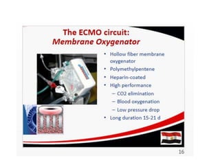 ECMO: Extracorporial Membrane Oxygenation | PDF