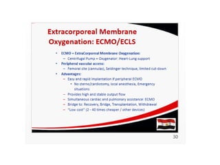 ECMO: Extracorporial Membrane Oxygenation | PDF