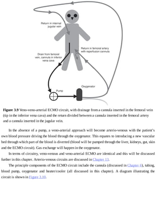 Figure	3.9	Veno-veno-arterial	ECMO	circuit,	with	drainage	from	a	cannula	inserted	in	the	femoral	vein
(tip	in	the	inferior	vena	cava)	and	the	return	divided	between	a	cannula	inserted	in	the	femoral	artery
and	a	cannula	inserted	in	the	jugular	vein.
In	the	absence	of	a	pump,	a	veno-arterial	approach	will	become	arterio-venous	with	the	patient’s
own	blood	pressure	driving	the	blood	through	the	oxygenator.	This	equates	to	introducing	a	new	vascular
bed	through	which	part	of	the	blood	is	diverted	(blood	will	be	pumped	through	the	liver,	kidneys,	gut,	skin
and	the	ECMO	circuit).	Gas	exchange	will	happen	in	the	oxygenator.
In	terms	of	circuitry,	veno-venous	and	veno-arterial	ECMO	are	identical	and	this	will	be	discussed
further	in	this	chapter.	Arterio-venous	circuits	are	discussed	in	Chapter	13.
The	principle	components	of	the	ECMO	circuit	include	the	cannula	(discussed	in	Chapter	6),	tubing,
blood	 pump,	 oxygenator	 and	 heater/cooler	 (all	 discussed	 in	 this	 chapter).	 A	 diagram	 illustrating	 the
circuit	is	shown	in	Figure	3.10.
 