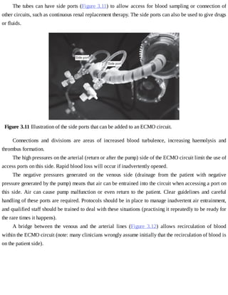 The	tubes	can	have	side	ports	(Figure	3.11)	to	allow	access	for	blood	sampling	or	connection	of
other	circuits,	such	as	continuous	renal	replacement	therapy.	The	side	ports	can	also	be	used	to	give	drugs
or	fluids.
Figure	3.11	Illustration	of	the	side	ports	that	can	be	added	to	an	ECMO	circuit.
Connections	 and	 divisions	 are	 areas	 of	 increased	 blood	 turbulence,	 increasing	 haemolysis	 and
thrombus	formation.
The	high	pressures	on	the	arterial	(return	or	after	the	pump)	side	of	the	ECMO	circuit	limit	the	use	of
access	ports	on	this	side.	Rapid	blood	loss	will	occur	if	inadvertently	opened.
The	 negative	 pressures	 generated	 on	 the	 venous	 side	 (drainage	 from	 the	 patient	 with	 negative
pressure	generated	by	the	pump)	means	that	air	can	be	entrained	into	the	circuit	when	accessing	a	port	on
this	 side.	 Air	 can	 cause	 pump	 malfunction	 or	 even	 return	 to	 the	 patient.	 Clear	 guidelines	 and	 careful
handling	of	these	ports	are	required.	Protocols	should	be	in	place	to	manage	inadvertent	air	entrainment,
and	qualified	staff	should	be	trained	to	deal	with	these	situations	(practising	it	repeatedly	to	be	ready	for
the	rare	times	it	happens).
A	 bridge	 between	 the	 venous	 and	 the	 arterial	 lines	 (Figure	 3.12)	 allows	 recirculation	 of	 blood
within	the	ECMO	circuit	(note:	many	clinicians	wrongly	assume	initially	that	the	recirculation	of	blood	is
on	the	patient	side).
 