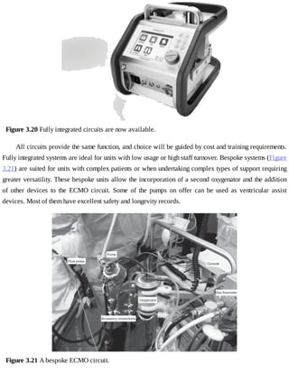 Figure	3.20	Fully	integrated	circuits	are	now	available.
All	circuits	provide	the	same	function,	and	choice	will	be	guided	by	cost	and	training	requirements.
Fully	integrated	systems	are	ideal	for	units	with	low	usage	or	high	staff	turnover.	Bespoke	systems	(Figure
3.21)	are	suited	for	units	with	complex	patients	or	when	undertaking	complex	types	of	support	requiring
greater	versatility.	These	bespoke	units	allow	the	incorporation	of	a	second	oxygenator	and	the	addition
of	 other	 devices	 to	 the	 ECMO	 circuit.	 Some	 of	 the	 pumps	 on	 offer	 can	 be	 used	 as	 ventricular	 assist
devices.	Most	of	them	have	excellent	safety	and	longevity	records.
Figure	3.21	A	bespoke	ECMO	circuit.
 