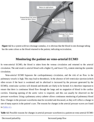 Figure	4.2	In	a	system	with	two	drainage	cannulas,	it	is	obvious	that	the	blood	in	one	drainage	tubing
has	the	same	colour	as	the	blood	returned	to	the	patient,	indicating	recirculation.
Monitoring	the	patient	on	veno-arterial	ECMO
In	 veno-arterial	 ECMO,	 the	 blood	 is	 taken	 from	 the	 venous	 circulation	 and	 returned	 to	 the	 arterial
circulation.	The	end	result	is	arterial	blood	with	a	higher	O2	and	lower	CO2	content	entering	the	systemic
circulation.
Veno-arterial	 ECMO	 bypasses	 the	 cardiopulmonary	 circulation,	 and	 the	 risk	 of	 no	 flow	 in	 the
pulmonary	vessels	is	high.	This	may	lead	to	thrombosis.	In	the	absence	of	left	ventricular	ejection	(which
often	 occurs	 if	 the	 heart	 is	 weakened	 and	 its	 afterload	 is	 increased	 by	 the	 pressure	 generated	 by	 the
ECMO),	ventricular	cavities	will	distend	and	thrombi	are	likely	to	be	formed.	It	is	therefore	important	to
ensure	that	there	is	continuous	blood	flow	through	the	lungs	and	no	stagnation	of	blood	in	the	cardiac
cavities.	 Ensuring	 opening	 of	 the	 aortic	 valve	 is	 required,	 and	 this	 can	 usually	 be	 observed	 on	 the
pressure	waveform.	Using	a	pulmonary	artery	catheter	allows	continuous	monitoring	of	pulmonary	blood
flow.	Changes	in	the	pressure	waveforms	must	be	recorded	and	discussed,	as	they	will	reflect	a	change	in
one	of	many	aspects	in	the	patient’s	care.	The	reasons	for	changes	in	the	arterial	pressure	waves	are	listed
in	Table	4.1.
Table	4.1	Possible	reasons	for	changes	in	arterial	pressure	waveform	in	a	patient	on	veno-arterial	ECMO
Decreased	pulsatility Increased	pump	flow
 