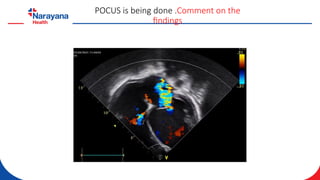 ECMO case scenarios (Venovenous and Venoarterial).pptx