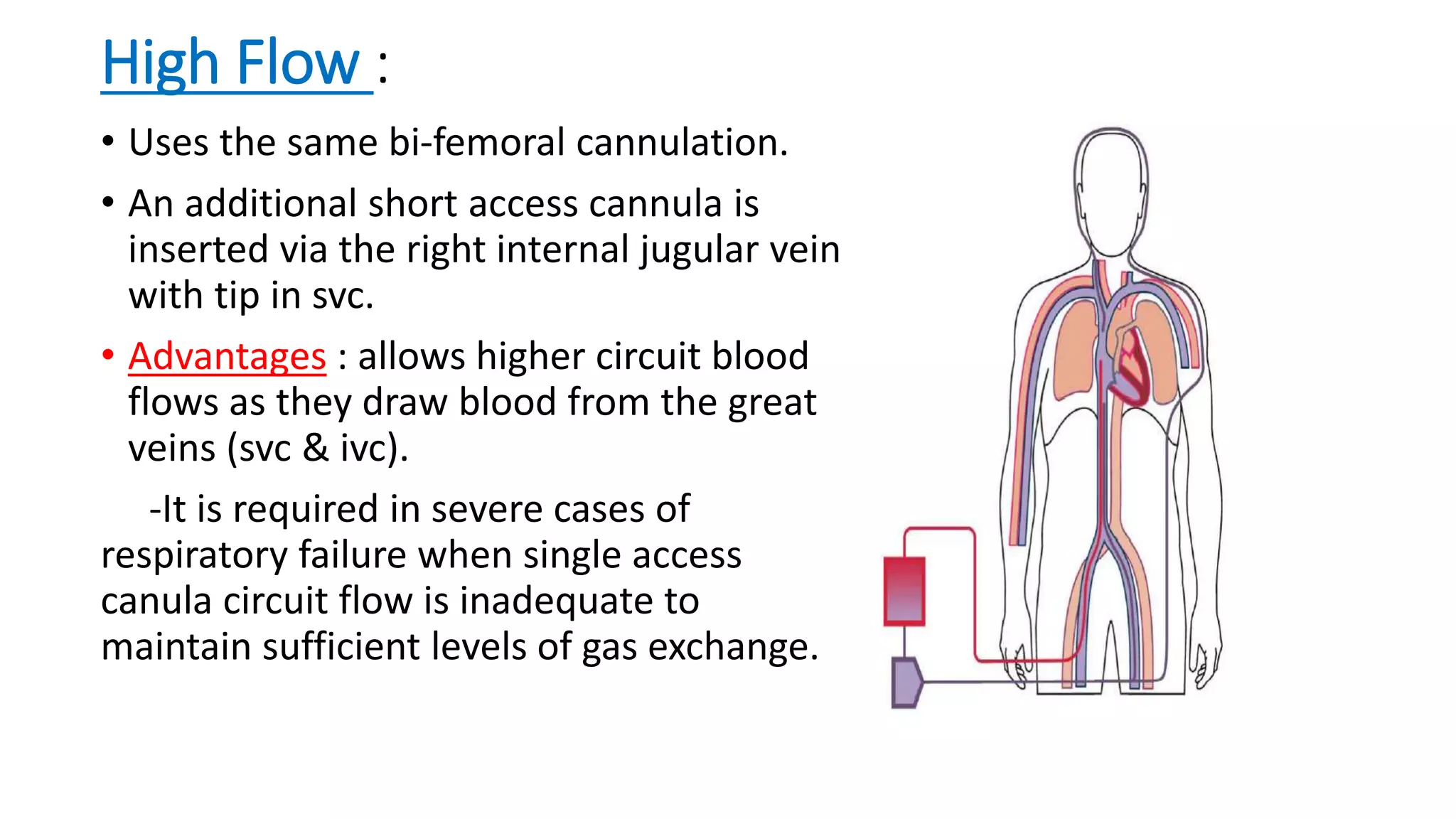 High Flow :
• Uses the same bi-femoral cannulation.
• An additional short access cannula is
inserted via the right internal jugular vein
with tip in svc.
• Advantages : allows higher circuit blood
flows as they draw blood from the great
veins (svc & ivc).
-It is required in severe cases of
respiratory failure when single access
canula circuit flow is inadequate to
maintain sufficient levels of gas exchange.
 