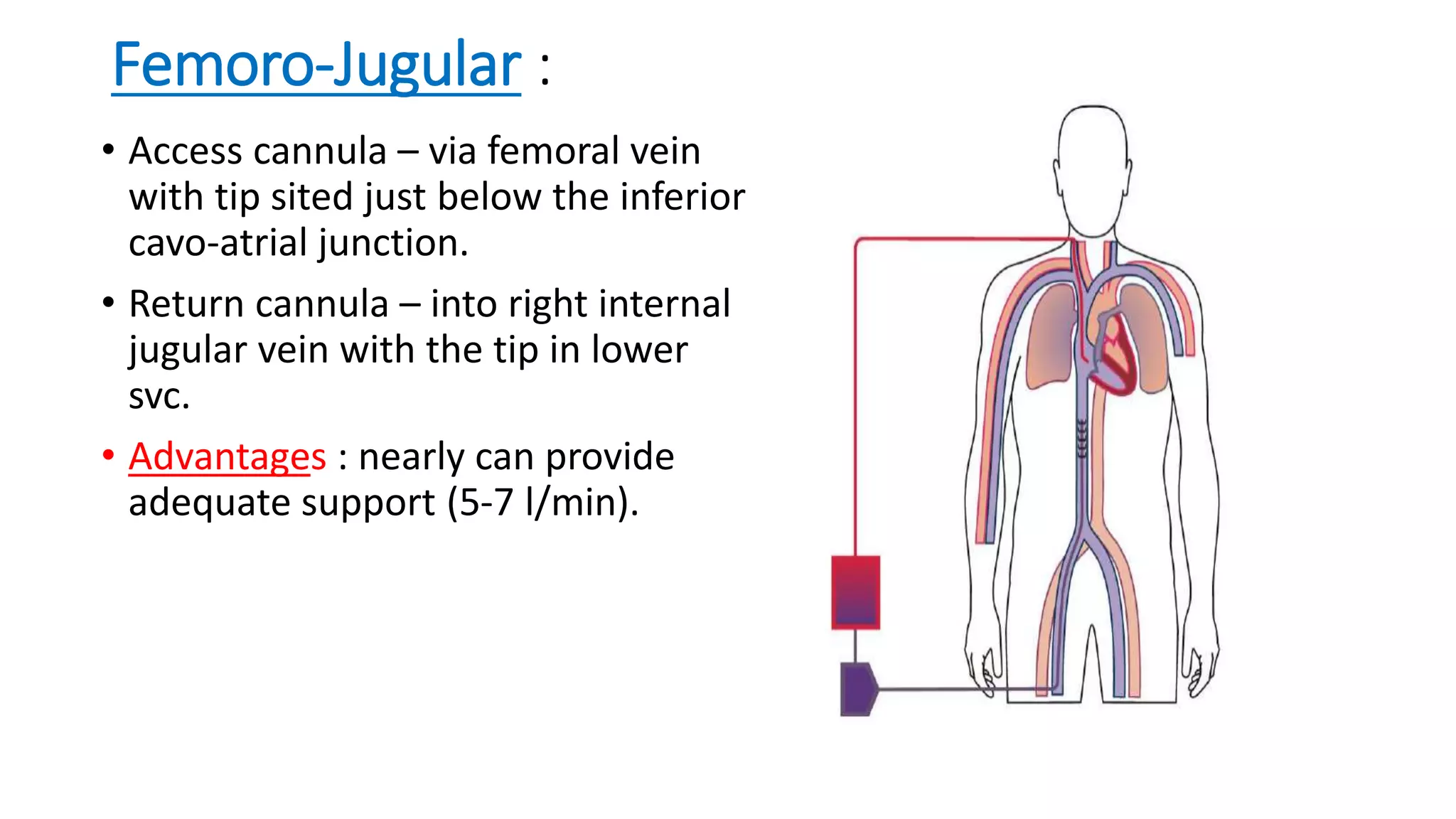 Femoro-Jugular :
• Access cannula – via femoral vein
with tip sited just below the inferior
cavo-atrial junction.
• Return cannula – into right internal
jugular vein with the tip in lower
svc.
• Advantages : nearly can provide
adequate support (5-7 l/min).
 