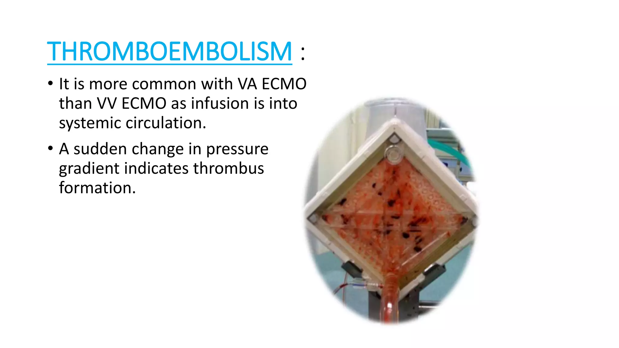 THROMBOEMBOLISM :
• It is more common with VA ECMO
than VV ECMO as infusion is into
systemic circulation.
• A sudden change in pressure
gradient indicates thrombus
formation.
 