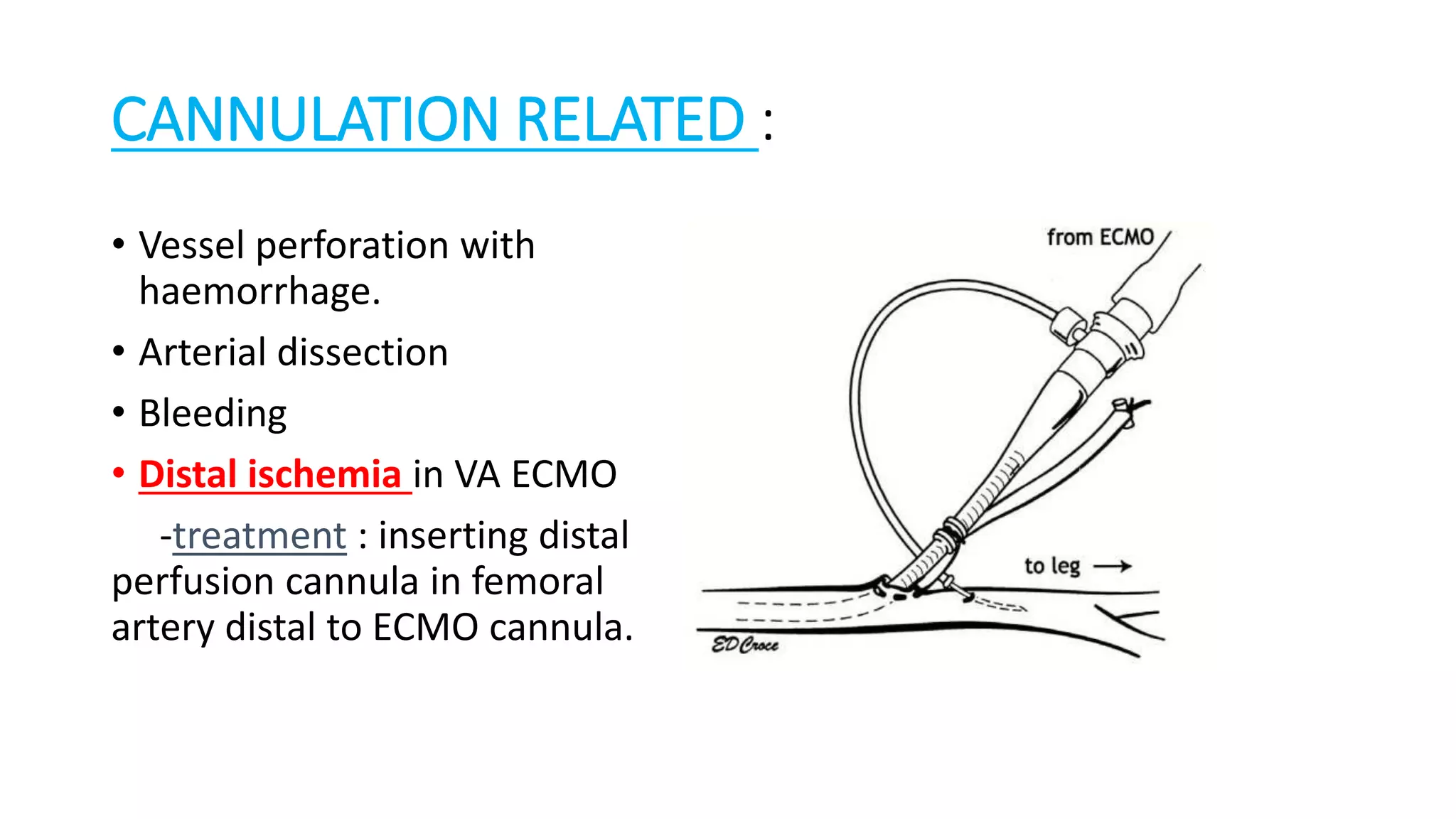 CANNULATION RELATED :
• Vessel perforation with
haemorrhage.
• Arterial dissection
• Bleeding
• Distal ischemia in VA ECMO
-treatment : inserting distal
perfusion cannula in femoral
artery distal to ECMO cannula.
 