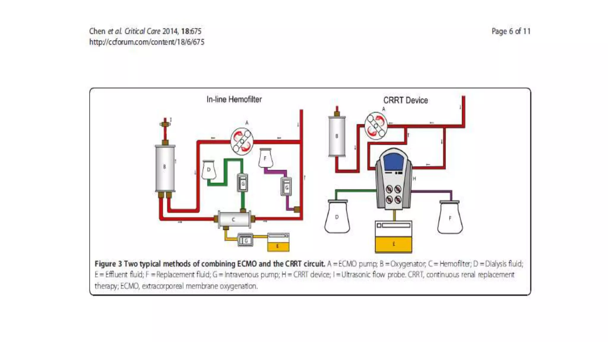 ECMO - extracorporeal membrane oxygenation