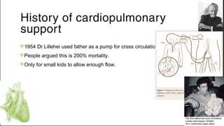 v1954 Dr Lillehei used father as a pump for cross circulation.
vPeople argued this is 200% mortality.
vOnly for small kids to allow enough flow.
History of cardiopulmonary
support
 