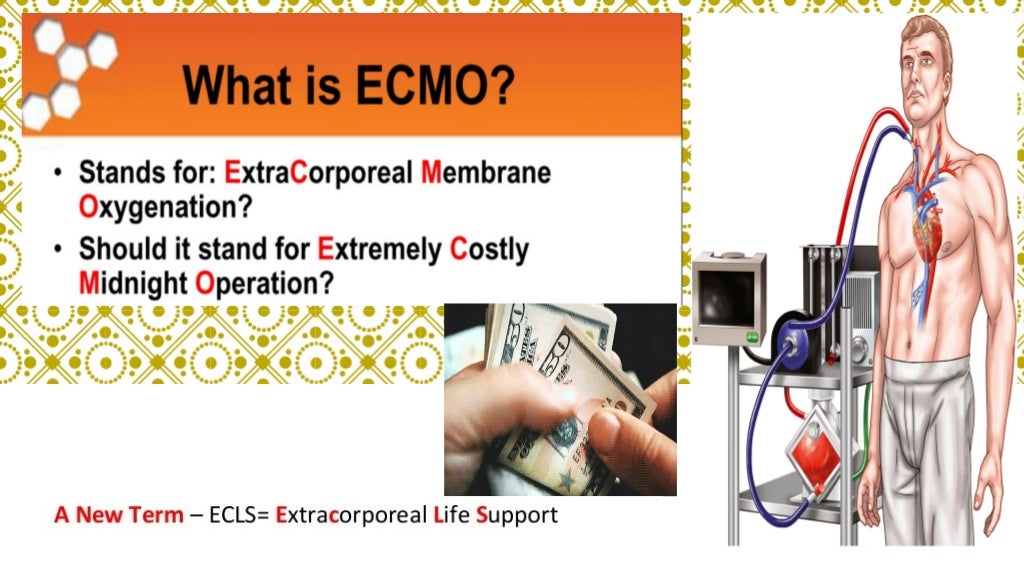Ecmo history, indications, cannulation, complications