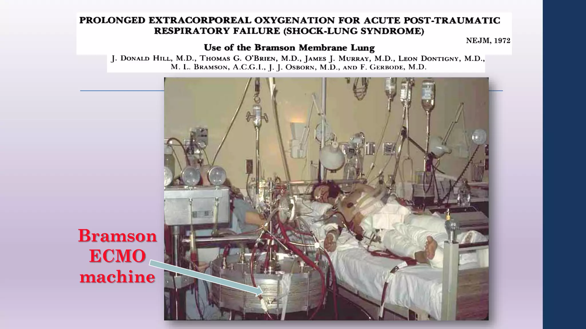 NEJM, 1972
Bramson
ECMO
machine
 