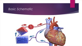 Ecmo - a basic overview. | PPT