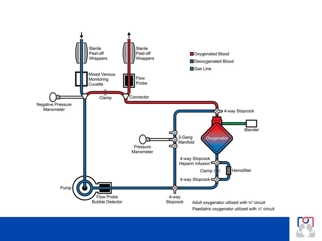 ECMO Overview basic concepts eco made easy.pdf