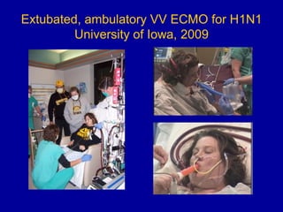 Uihc Emcmo Ecmo : Past, Present & Future | PDF