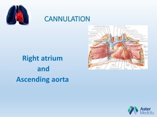 CANNULATION
Right atrium
and
Ascending aorta
 