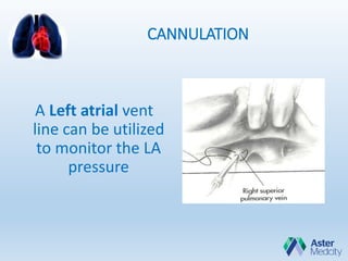 CANNULATION
A Left atrial vent
line can be utilized
to monitor the LA
pressure
 