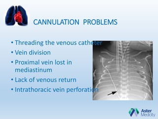 CANNULATION PROBLEMS
• Threading the venous catheter
• Vein division
• Proximal vein lost in
mediastinum
• Lack of venous return
• Intrathoracic vein perforation
 