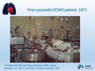 First successful ECMO patient, 1971
J Donald Hill MD and Maury Bramson BME, Santa
Barbara, Ca, 1971. (Courtesy of Robert Bartlett, MD)
 