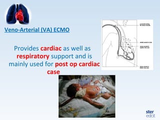 Veno-Arterial (VA) ECMO
Provides cardiac as well as
respiratory support and is
mainly used for post op cardiac
case
 