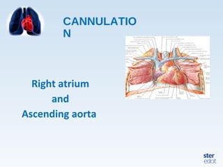 CANNULATIO
N
Right atrium
and
Ascending aorta
 