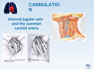 CANNULATIO
N
Internal jugular vein
and the common
carotid artery
 