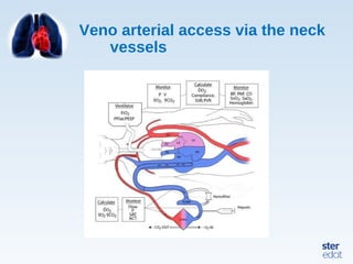 Veno arterial access via the neck
vessels
 