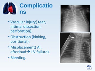 Complicatio
ns
• Vascular injury( tear,
intimal dissection,
perforation).
• Obstruction (kinking,
positional).
• Misplacement( AI,
afterload LV failure).
• Bleeding.
 