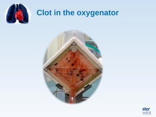 Clot in the oxygenator
 