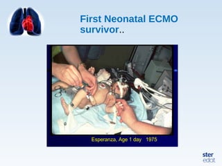 First Neonatal ECMO
survivor..
Esperanza, Age 1 day 1975
 