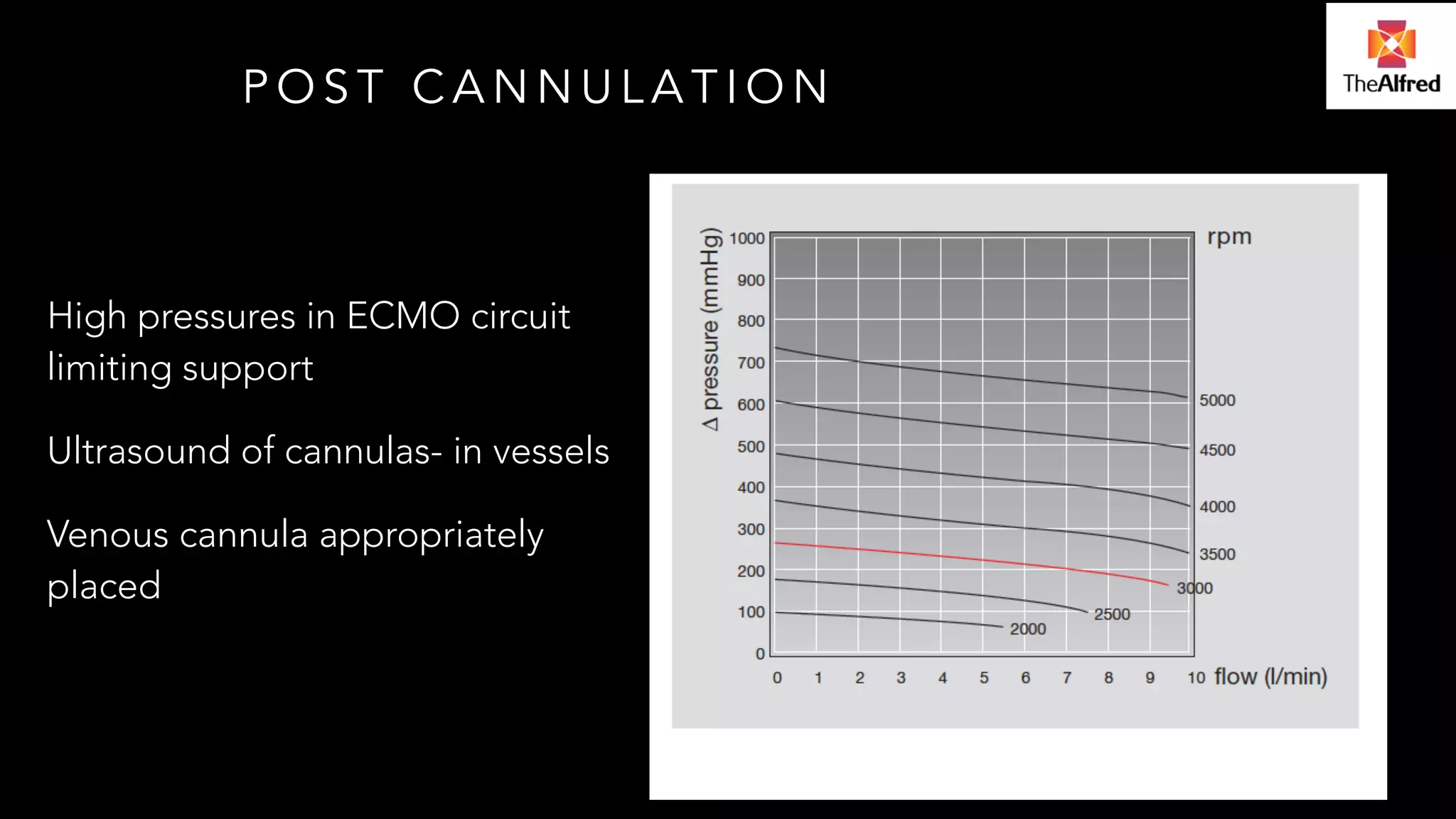 POST CANNULATION 
High pressures in ECMO circuit 
limiting support 
Ultrasound of cannulas- in vessels 
Venous cannula appropriately 
placed 
 