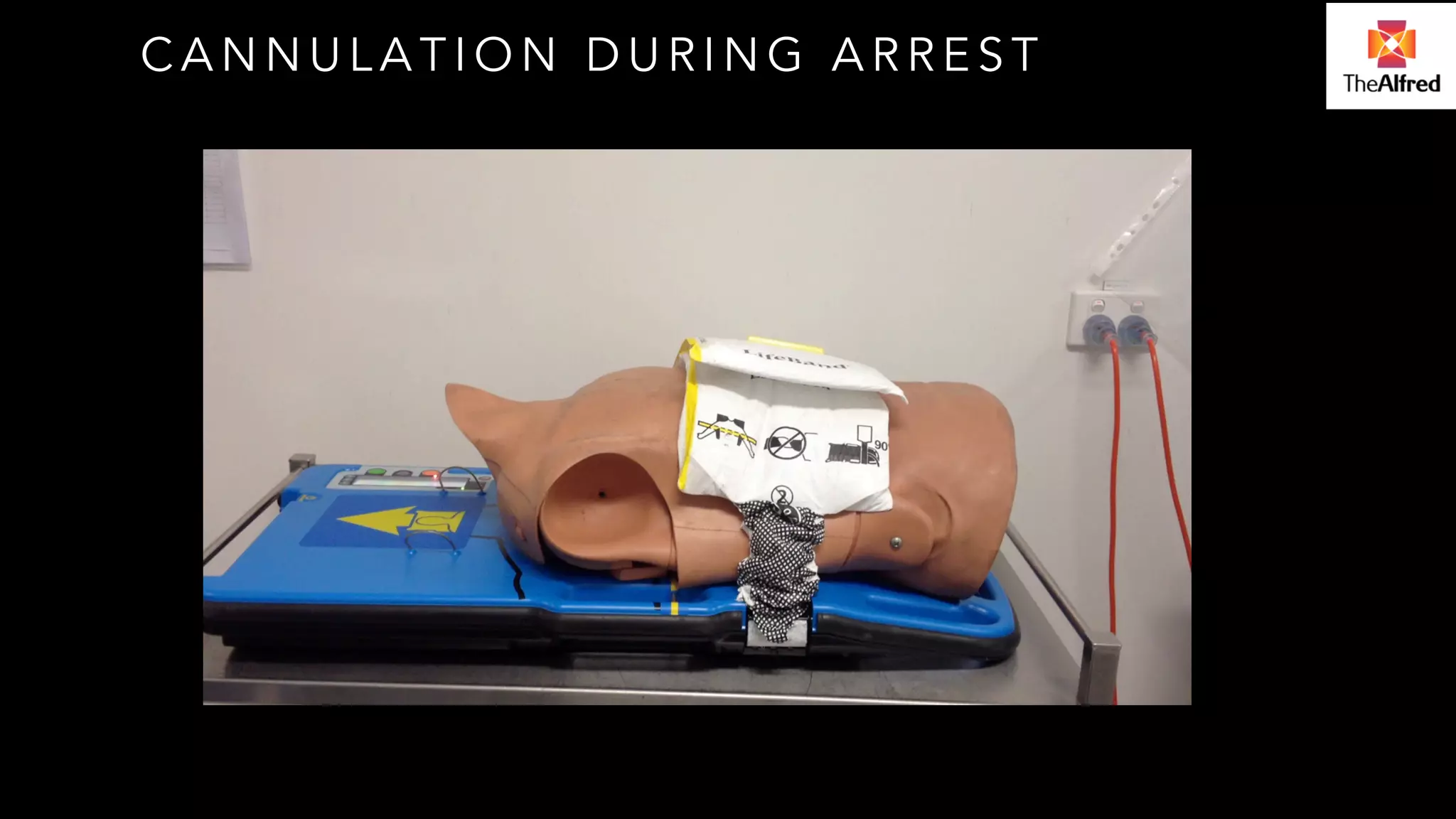 CANNULATION DURING ARREST 
 