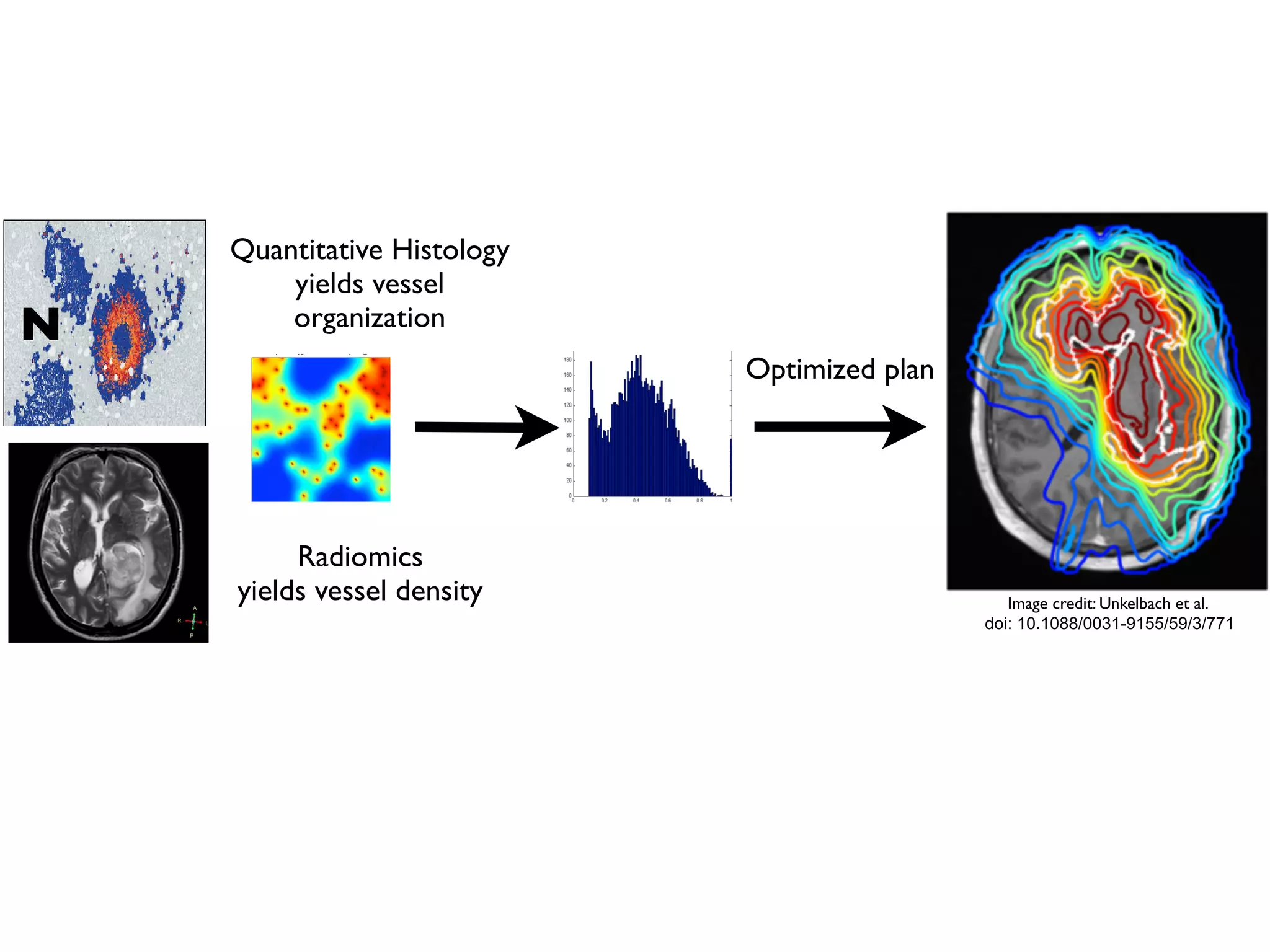 alinen et al. Phys Med Biol 2006 2. Corwin et al. PLoS ONE 2013 3. Alfonso et al., PLoS ONE 2014 4. Leder et al, Cell 2014 5. Gaedicke et al., PNAS 2014. 6. Scott et al. PLoS Comp Bi
ACKNOWLEDGEMENT: This work sponsored in part by the Moffitt Cancer Center PSOC, NIH/NCI U54CA143970
ue. (A) Representative immunohistochemistry (IHC) staining of pimonidazole in orthotopic
ap water or water containing sodium bicarbonate to drink. (B) Computational segmentation
ues. (C) Positive pixel analysis of segmented viable tissue showing intensity of pimonidazole
orange indicates moderate staining, and red indicates strong staining.
N
Quantitative Histology
yields vessel
organization
Radiomics
yields vessel density
Oxygen concentration (mmHG) Oxygen concentration (mmHG)
Enabling translation - information from several scales
Optimized plan
Image credit: Unkelbach et al.
doi: 10.1088/0031-9155/59/3/771
 