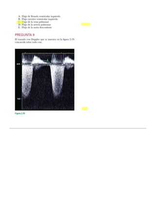 Principios basicos de ecocardiogramaaaaa