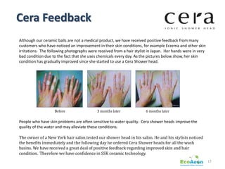 Cera Feedback
Although our ceramic balls are not a medical product, we have received positive feedback from many
customers who have noticed an improvement in their skin conditions, for example Eczema and other skin
irritations. The following photographs were received from a hair stylist in Japan. Her hands were in very
bad condition due to the fact that she uses chemicals every day. As the pictures below show, her skin
condition has gradually improved since she started to use a Cera Shower head.




                    Before                 3 months later              6 months later

People who have skin problems are often sensitive to water quality. Cera shower heads improve the
quality of the water and may alleviate these conditions.

The owner of a New York hair salon tested our shower head in his salon. He and his stylists noticed
the benefits immediately and the following day he ordered Cera Shower heads for all the wash
basins. We have received a great deal of positive feedback regarding improved skin and hair
condition. Therefore we have confidence in SSK ceramic technology.
                                                                                                            17
 