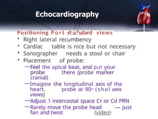Ecocardigram pptAn echocardiogram, also kno | PPTX