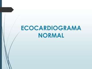 Ecocardiograma Modo M - Cardiología Guadalajara 
