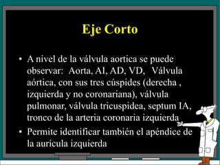Eje Corto
• A nivel de la válvula aortica se puede
observar: Aorta, AI, AD, VD, Válvula
aórtica, con sus tres cúspides (derecha ,
izquierda y no coronariana), válvula
pulmonar, válvula tricuspidea, septum IA,
tronco de la arteria coronaria izquierda
• Permite identificar también el apéndice de
la aurícula izquierda
 