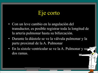 Eje corto
• Con un leve cambio en la angulación del
transductor, es posible registrar toda la longitud de
la arteria pulmonar hasta su bifurcación.
• Durante la diástole se ve la válvula pulmonar y la
parte proximal de la A. Pulmonar
• En la sístole ventricular se ve la A. Pulmonar y sus
dos ramas.
 