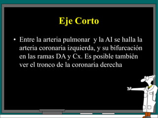 Eje Corto
• Entre la arteria pulmonar y la AI se halla la
arteria coronaria izquierda, y su bifurcación
en las ramas DA y Cx. Es posible también
ver el tronco de la coronaria derecha
 