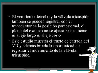 • El ventrículo derecho y la válvula tricúspide
también se pueden registrar con el
transductor en la posición paraesternal, el
plano del examen no se ajusta exactamente
ni al eje largo ni al eje corto
• Este estudio muestra el tracto de entrada del
VD y además brinda la oportunidad de
registrar el movimiento de la válvula
tricúspide.
 