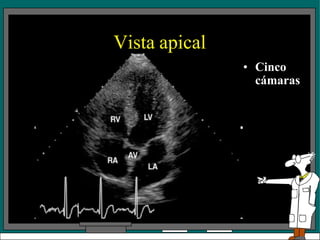 Vista apical
• Cinco
cámaras
 