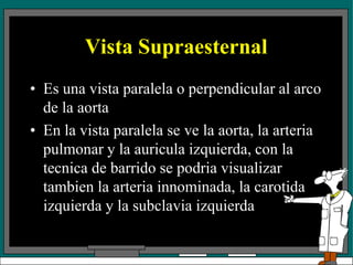 Vista Supraesternal
• Es una vista paralela o perpendicular al arco
de la aorta
• En la vista paralela se ve la aorta, la arteria
pulmonar y la auricula izquierda, con la
tecnica de barrido se podria visualizar
tambien la arteria innominada, la carotida
izquierda y la subclavia izquierda
 