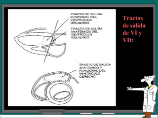 Tractos
de salida
de VI y
VD:
 