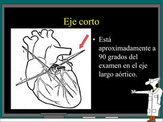 Eje corto
• Está
aproximadamente a
90 grados del
examen en el eje
largo aórtico.
 