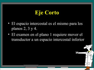 Eje Corto El espacio intercostal es el mismo para los planos 2, 3 y 4. El examen en el plano 1 requiere mover el transductor a un espacio intercostal inferior 