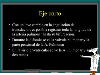 Eje corto Con un leve cambio en la angulación del transductor, es posible registrar toda la longitud de la arteria pulmonar hasta su bifurcación. Durante la diástole se ve la válvula pulmonar y la parte proximal de la A. Pulmonar En la sístole ventricular se ve la A. Pulmonar y sus dos ramas. 