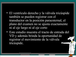 El ventrículo derecho y la válvula tricúspide también se pueden registrar con el transductor en la posición paraesternal, el plano del examen no se ajusta exactamente ni al eje largo ni al eje corto Este estudio muestra el tracto de entrada del VD y además brinda la oportunidad de registrar el movimiento de la válvula tricúspide. 