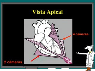 Vista Apical 2 cámaras 4 cámaras 