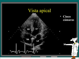 Vista apical Cinco cámaras 